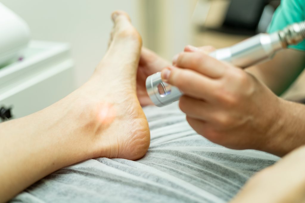 An,Unrecognizable,Podiatrist,Performs,Laser,Therapy,On,An,Athlete's,Foot.